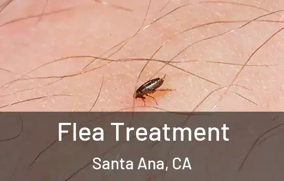  Flea Treatment Santa Ana, CA